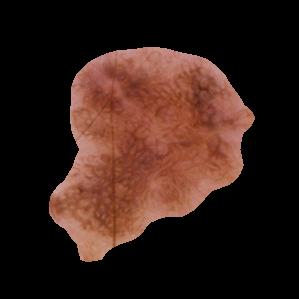 Melanoma Skin Cancer